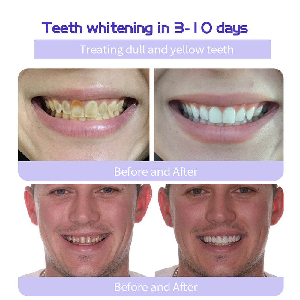 💰 60% OFF – TeethRestoration Mineral Powder ✨ ADA Approved & Dentist Recommended ✅