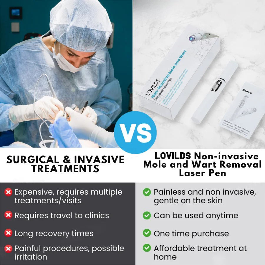 š„ćOFFICIAL STOREćLOVILDS⢠Non-Invasive Mole and Wart Removal Laser Pen