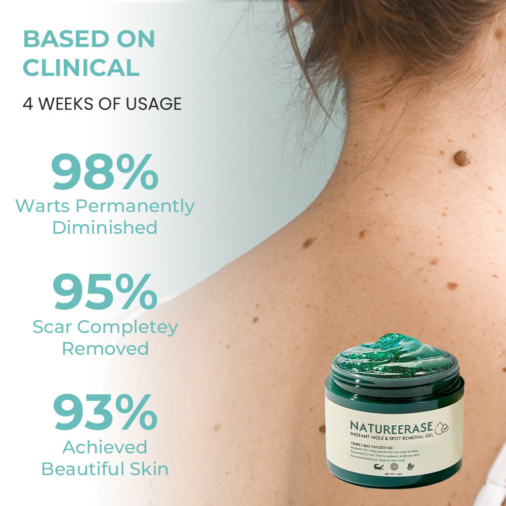 ✅ Official Store: LOVILDS™ Ultra NatureErase Instant Mole & Spot Removal Gel