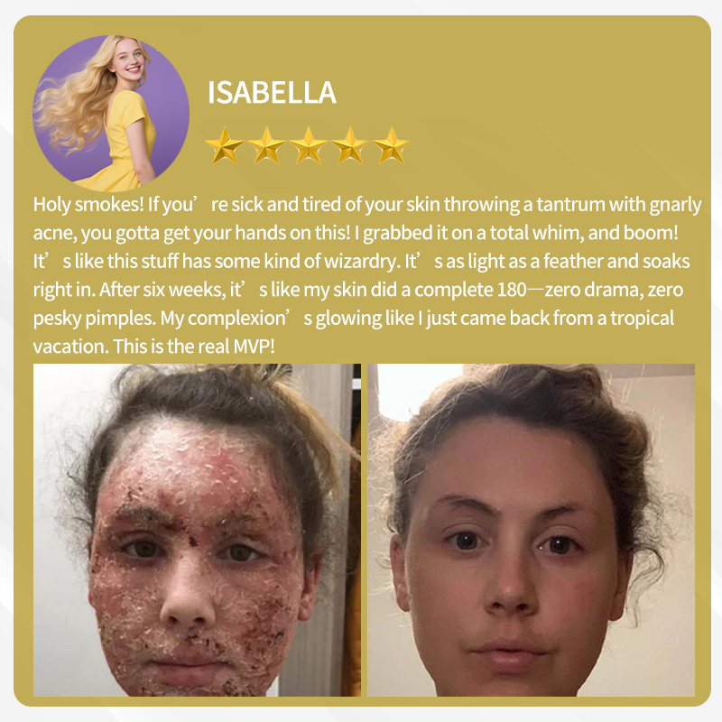 🔥FDA Approved: Bee Venom Skin Restoration Cream — 🔥Limited Time 80% OFF🔥
