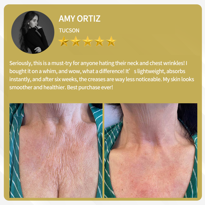 🔥FDA Approved: Bee Venom Skin Restoration Cream — 🔥Limited Time 80% OFF🔥