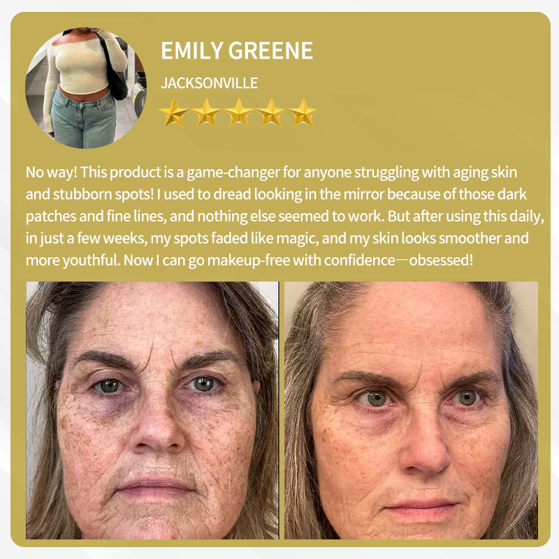 🔥FDA Approved: Bee Venom Skin Restoration Cream — 🔥Limited Time 80% OFF🔥
