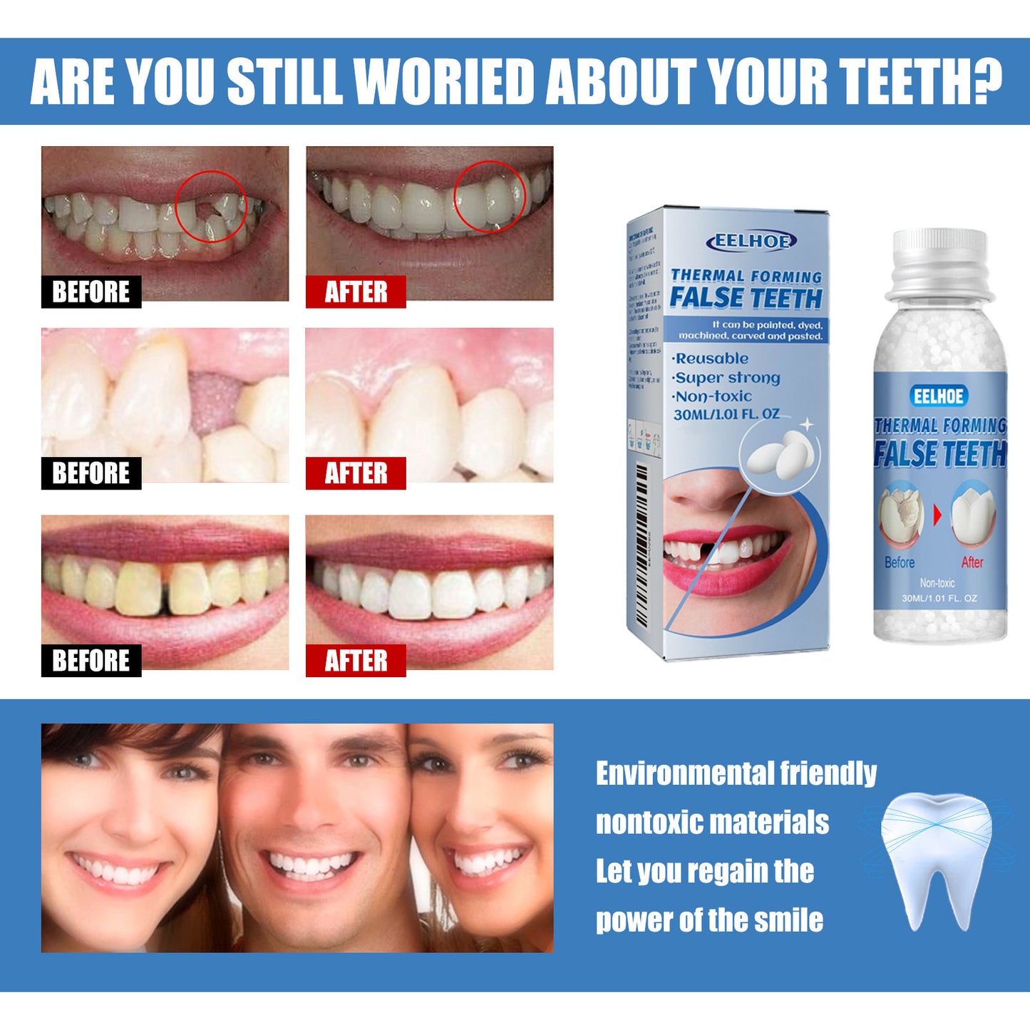 Resin Teeth Repair Glue
