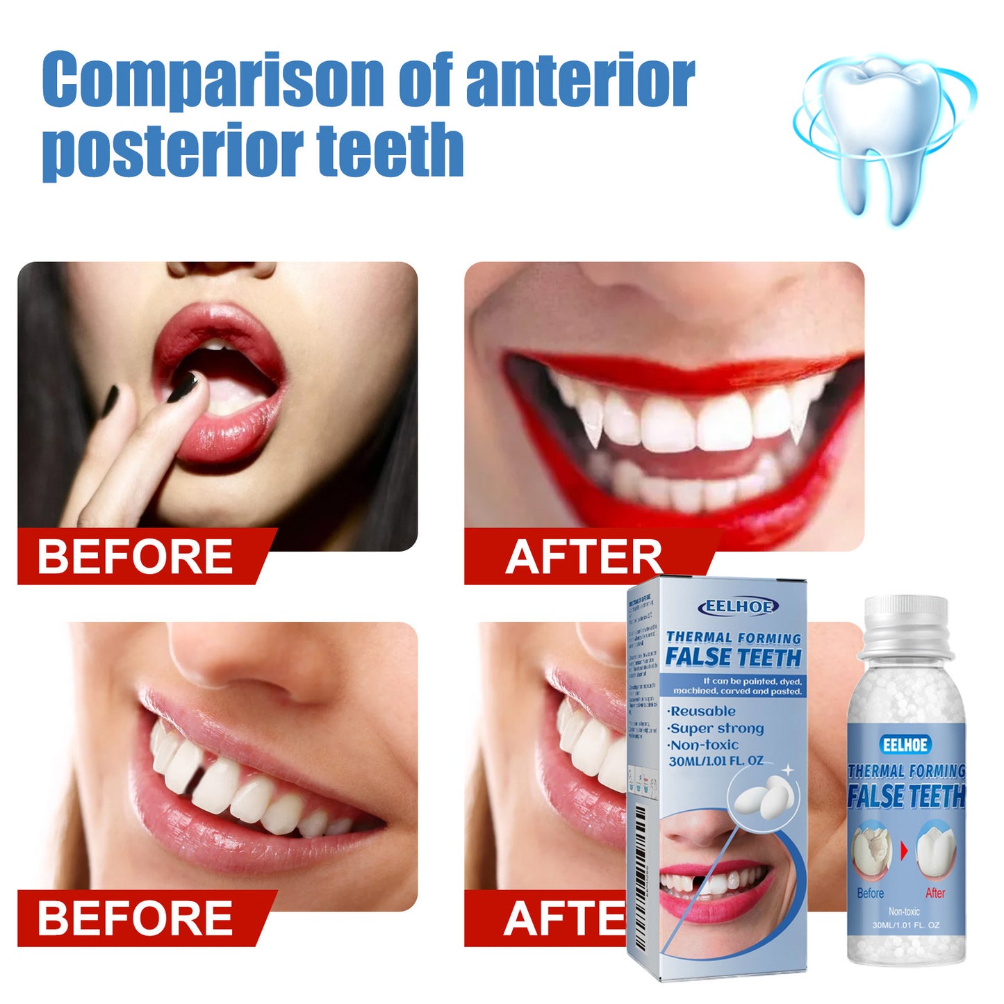 Resin Teeth Repair Glue