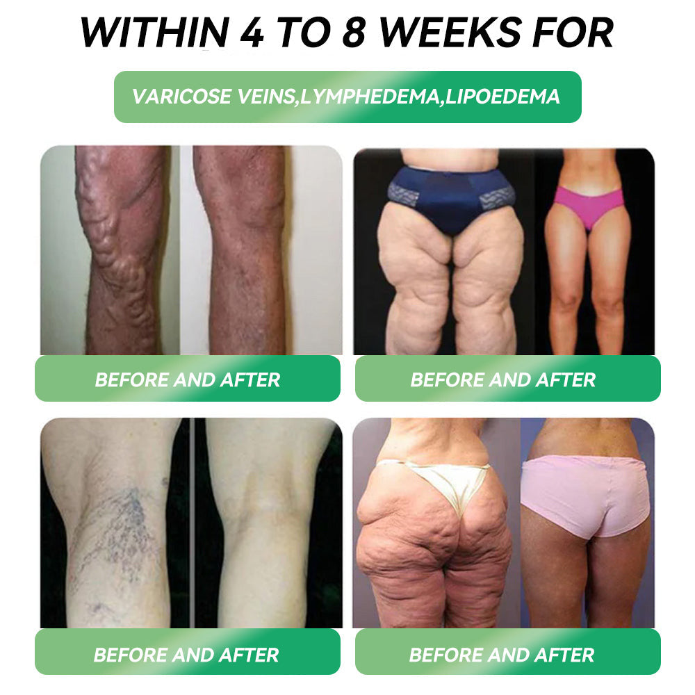 Only 10 boxes left! ⏰ Score an exclusive 30% off today! HHVB® endorsed by endocrinologists — 4 to 6 boxes recommended to keep the weight off and avoid rebound.  Last chance before the new year rolls around — don’t miss out! 🔥