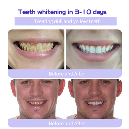 💰 60% OFF – TeethRestoration Mineral Powder ✨ ADA Approved & Dentist Recommended ✅