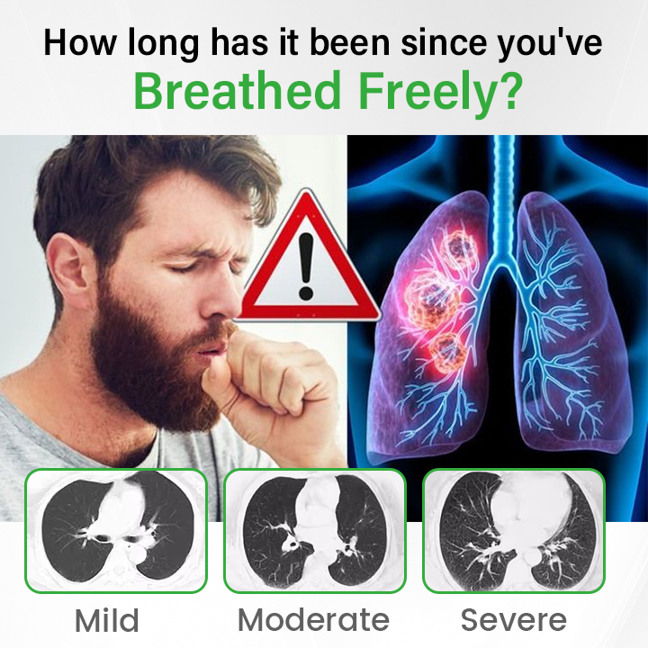 Natravor™ Pulmovia Quercetin Lung Detox Inhaler